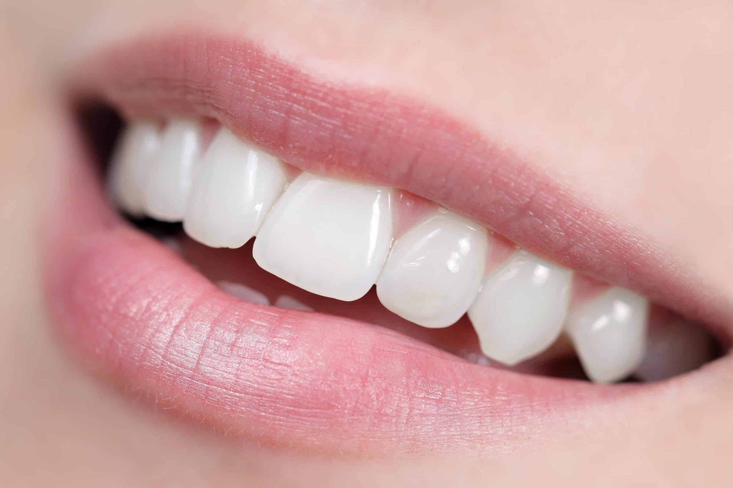 teeth whitening dentist aberdeen