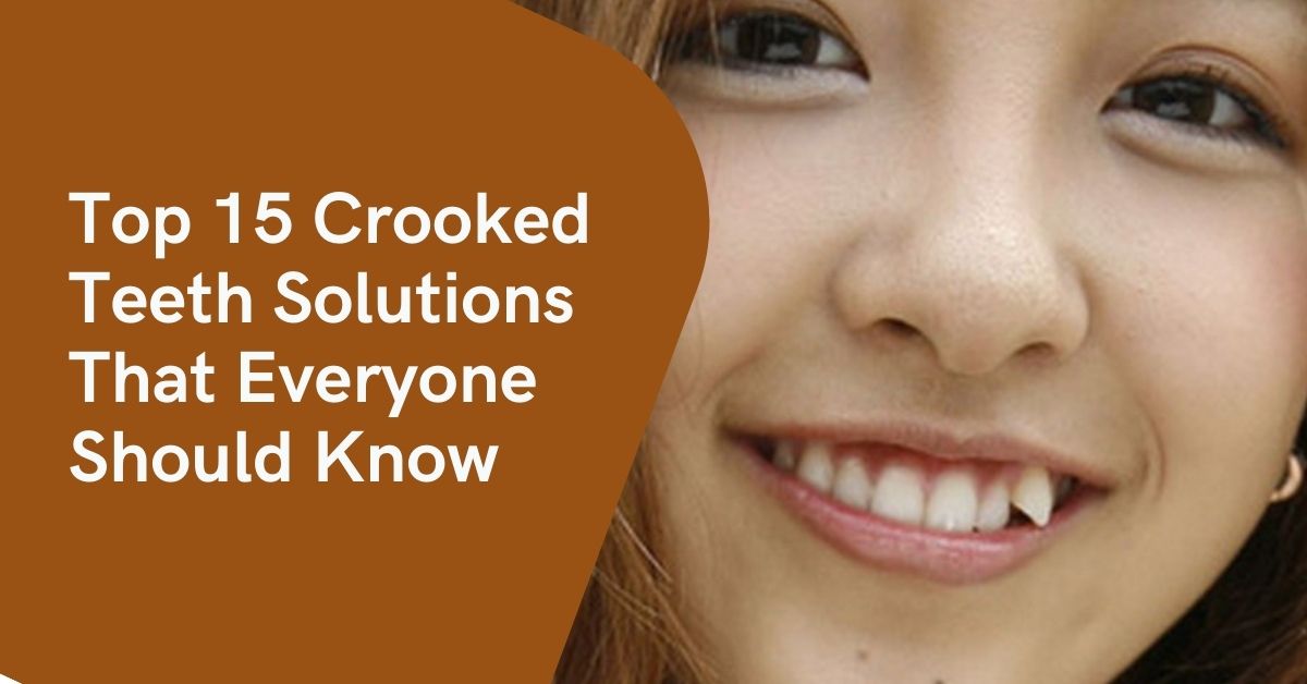 Top 15 Crooked Teeth Solutions That Everyone Should Know