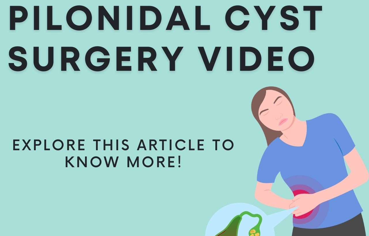 pilonidal cyst surgery video