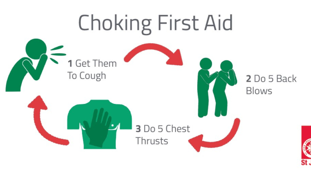 What Are the 15 Best Steps If Someone Is Choking?