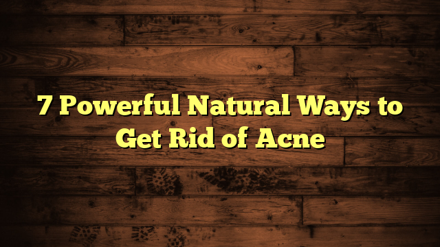 7 Powerful Natural Ways to Get Rid of Acne