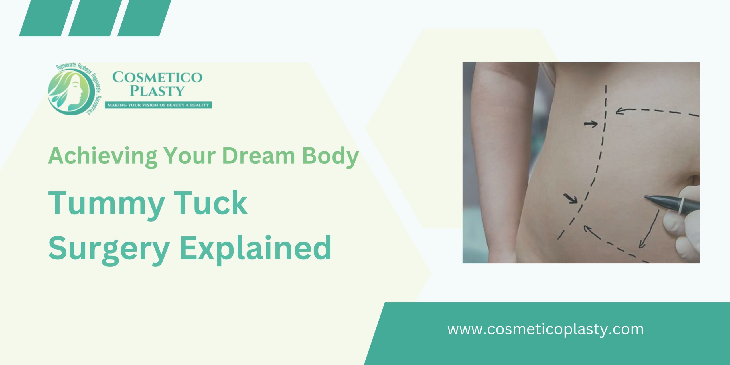 Achieving Your Dream Body Tummy Tuck Surgery Explained