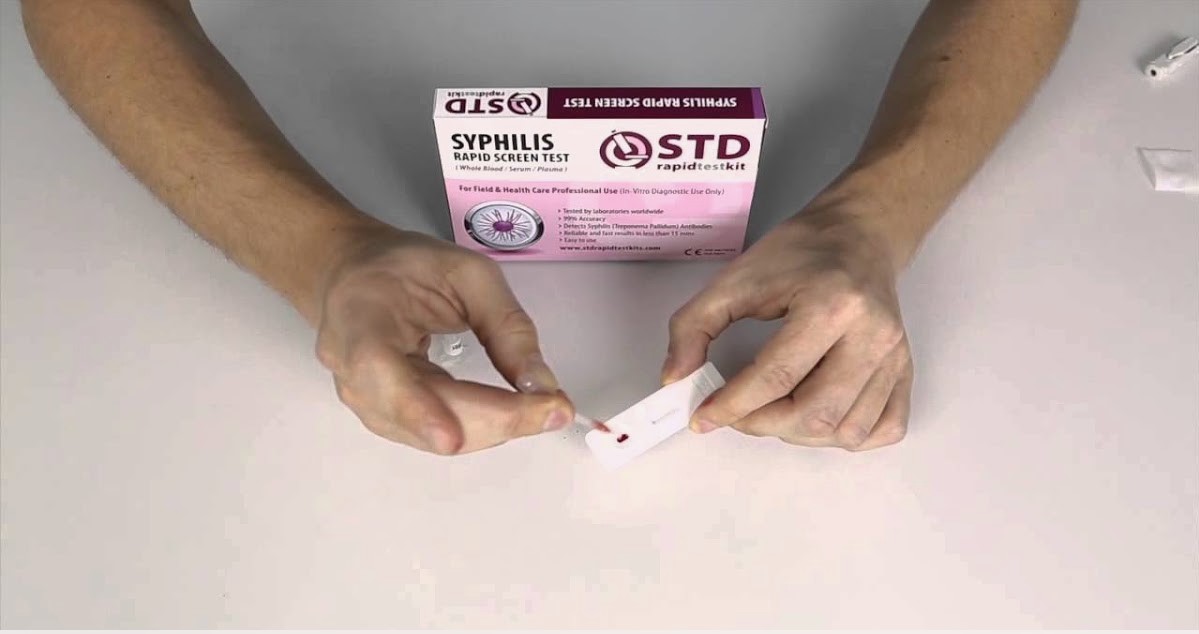 A man test syphilis sores